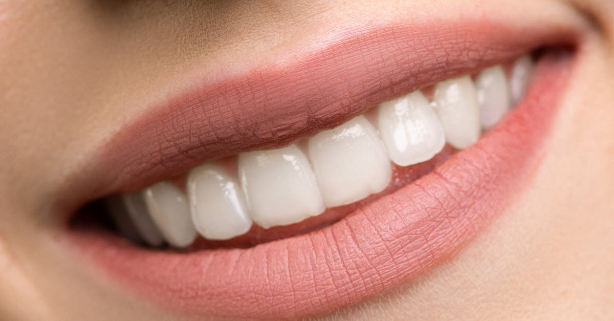 How often should I get a dental exam?